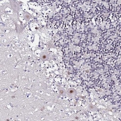 ACTL6B Antibody, Novus Biologicals 0.1mL; Unlabeled:Antibodies, Polyclonal